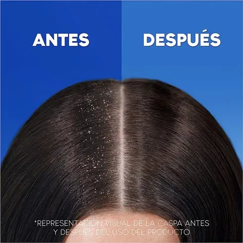 Champú Anticaspa H&S Citrus