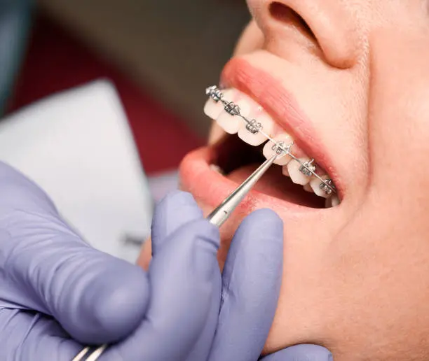 Día Mundial de la Salud Bucodental