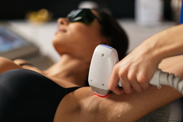 Depiladora Laser
